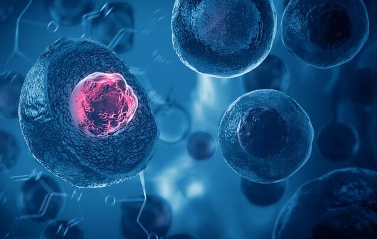 اندومتریوز، یک بیماری شایع در کمین زنان