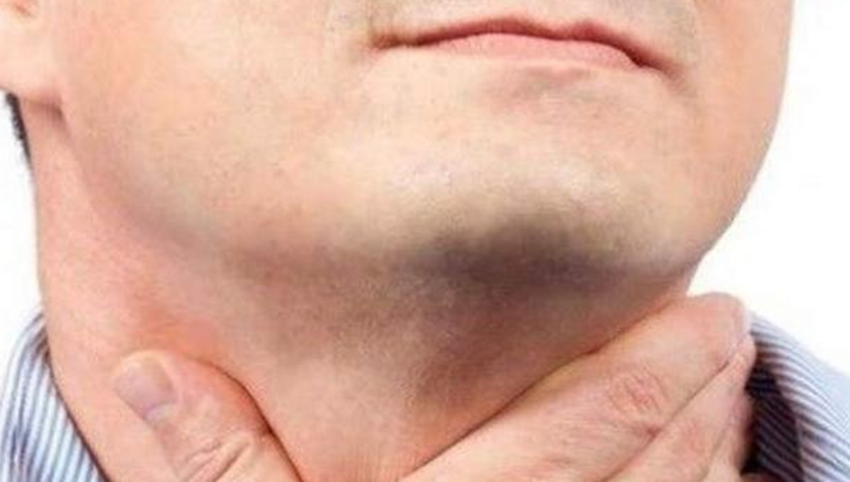 درد کلافه کننده گلو را با این روش‌ها از بین ببرید