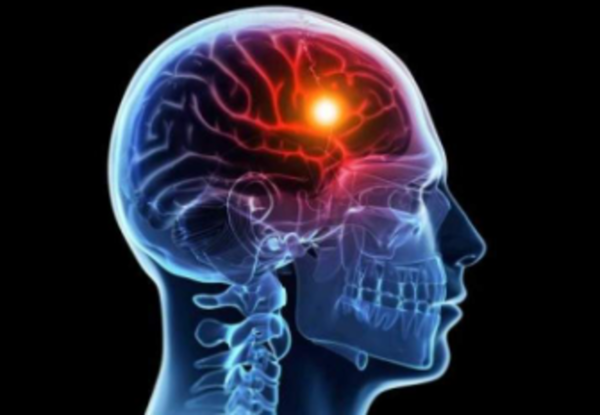 چربی پنهان شکمی و نشانه‌های آلزایمر!
