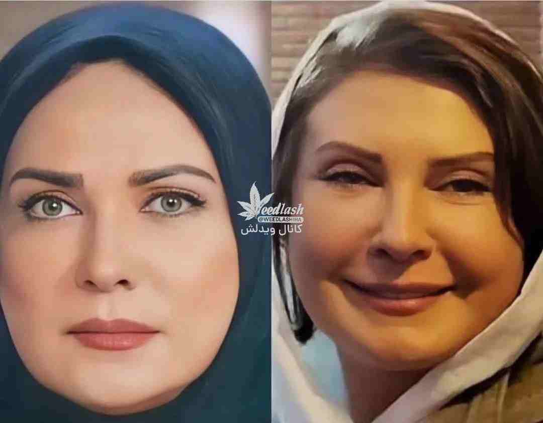 عمل زیبایی ناموفق لعیا زنگنه و بلایی که سر قیافش اومد+عکس