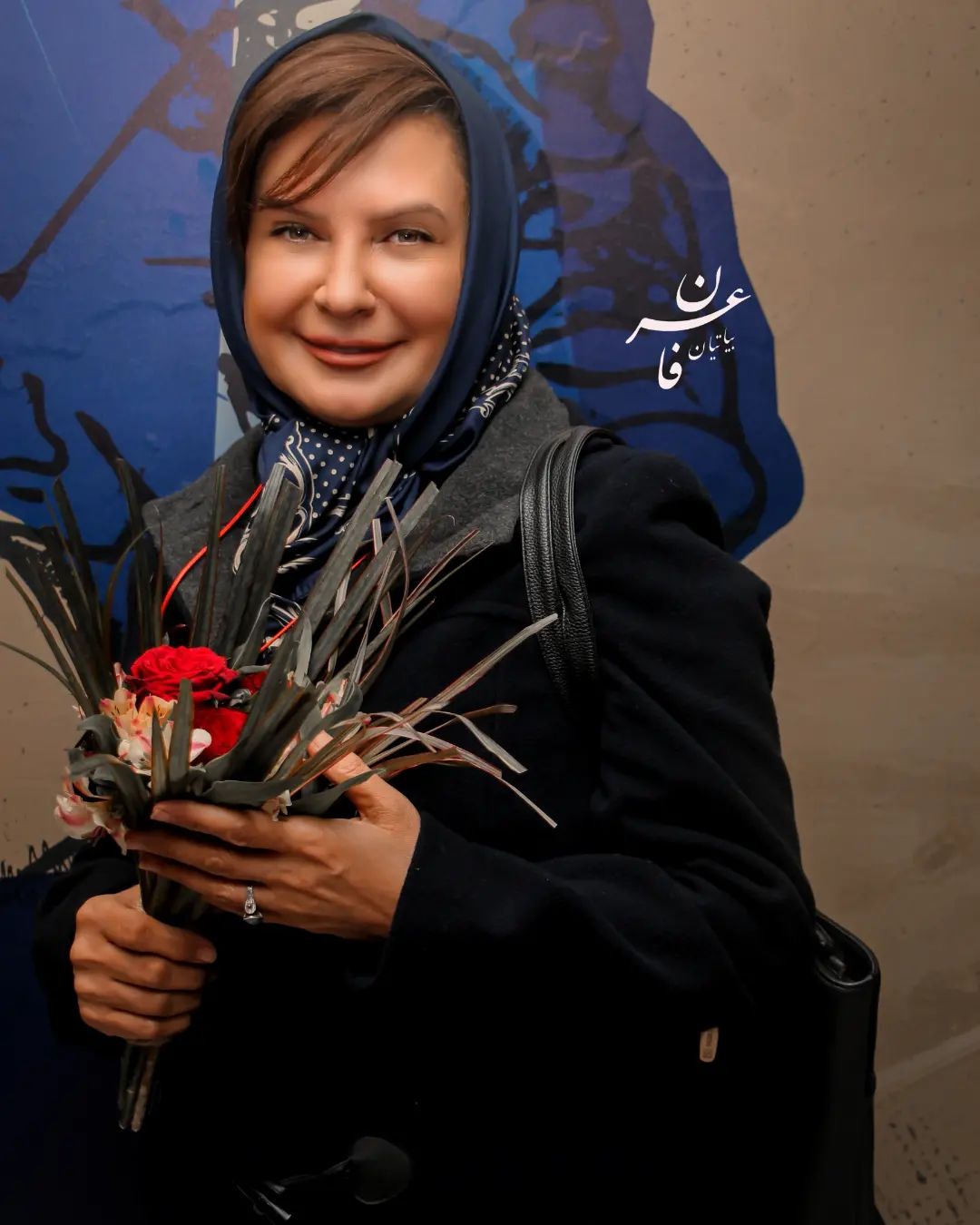عمل زیبایی ناموفق لعیا زنگنه و بلایی که سر قیافش اومد+عکس