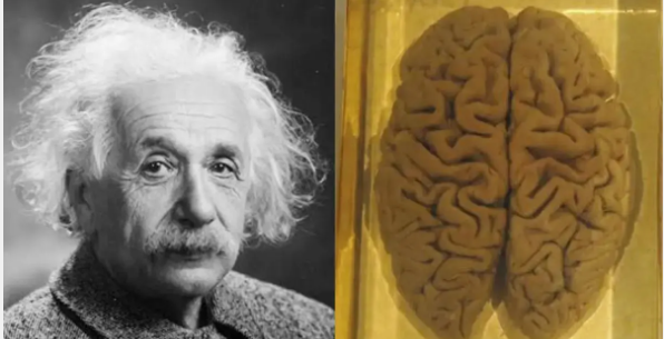 مغز انیشتین و فرق آن با سایر مغزها به روایت تصویر