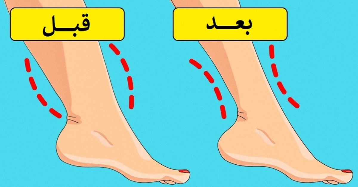 چاقی مچ پا میتواند یک مشکل پزشکی جدی باشد!