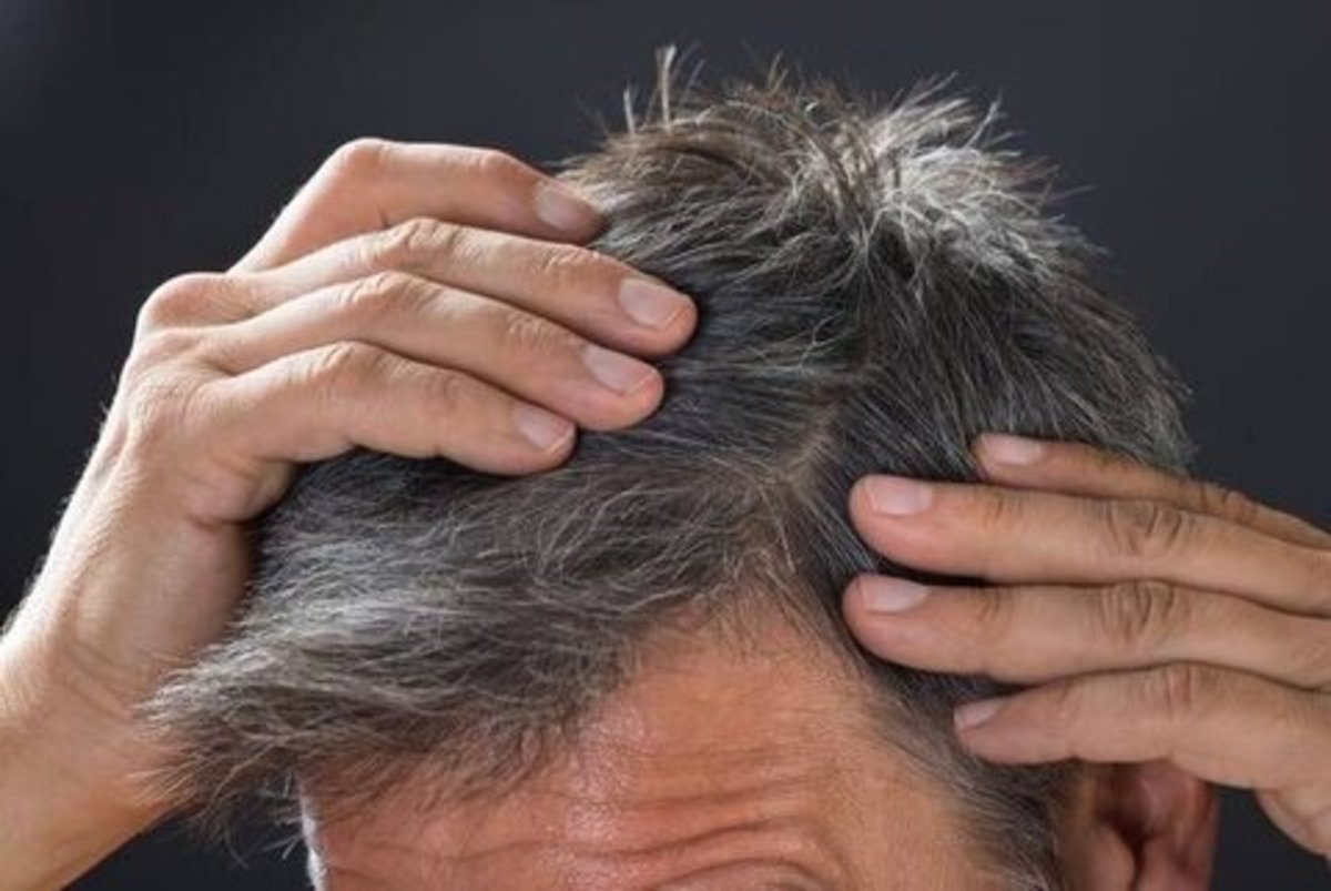 عارضه‌های رنگ کردن پرتکرار مو