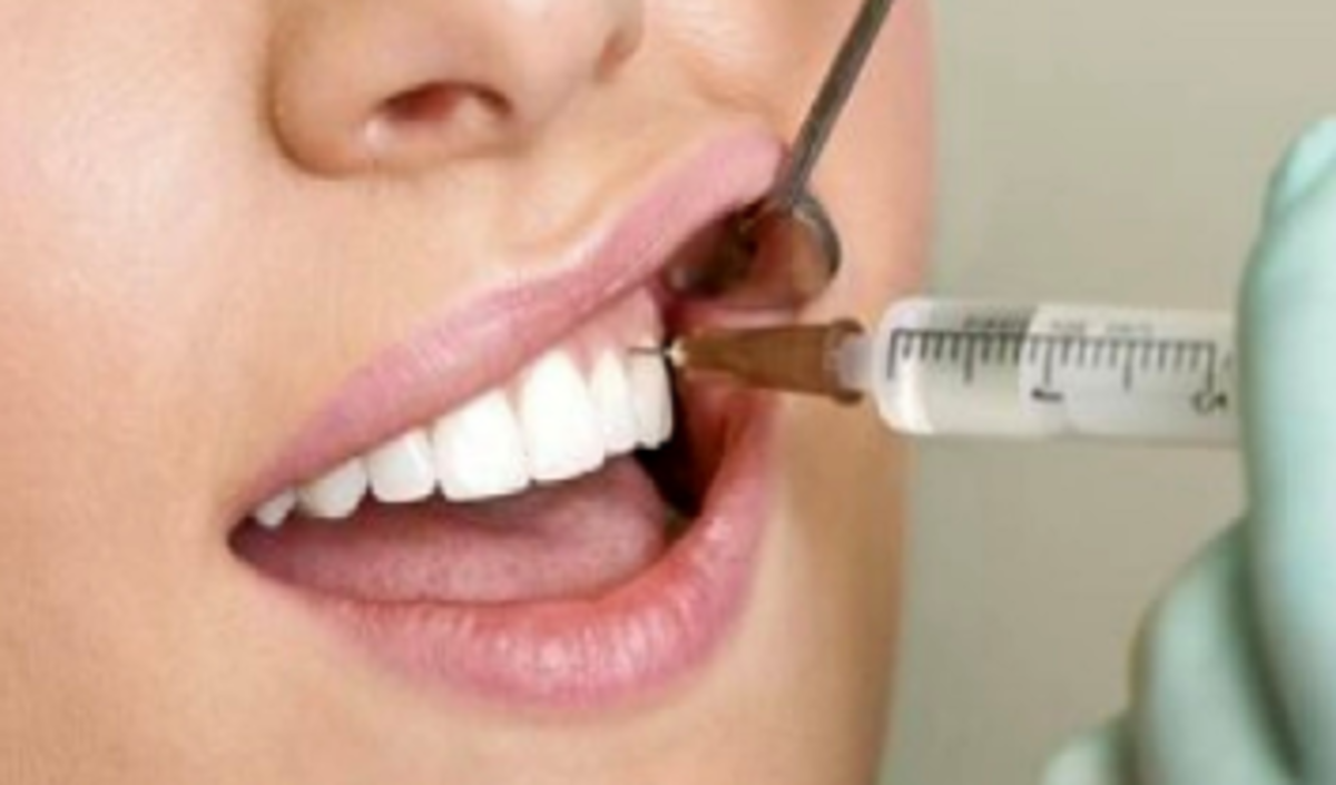 پوسیدگی دندان‌ها در پی چه بی ملاحظگی‌هایی رخ میدهد؟
