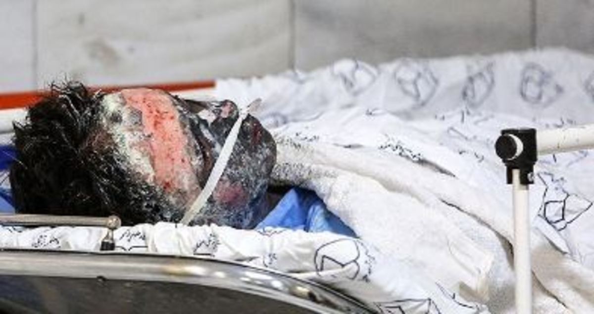 ۱۰۸ نفر در حوادث چهارشنبه پایان سال مصدوم شدند
