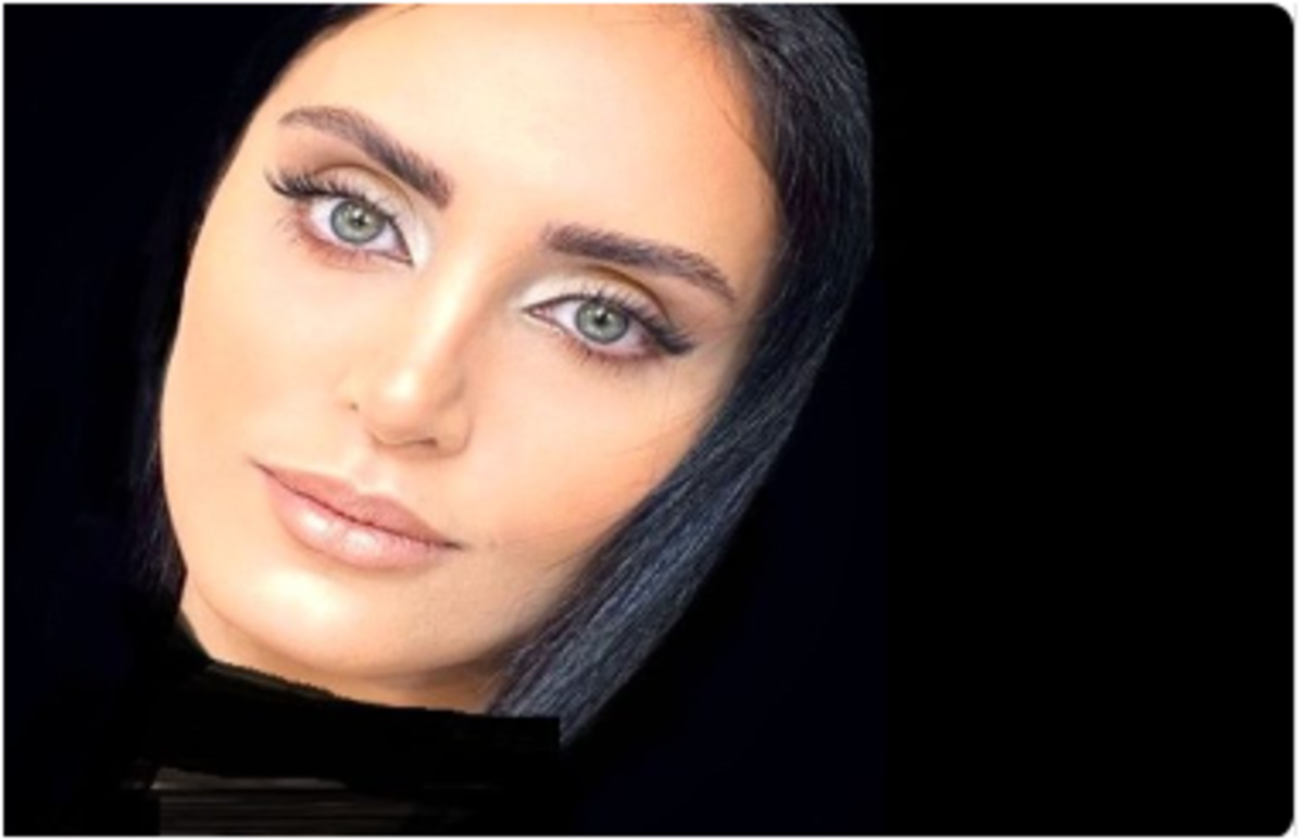 الناز شاکردوست دوباره بستری شد/حال خانم بازیگر چطور است؟