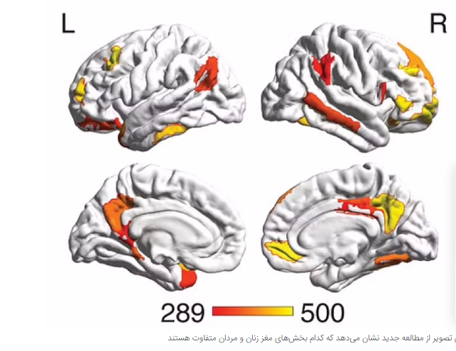 هوش مصنوعی یک گره دیگر را باز کرد، تفاوت مغز مردان و زنان کشف شد