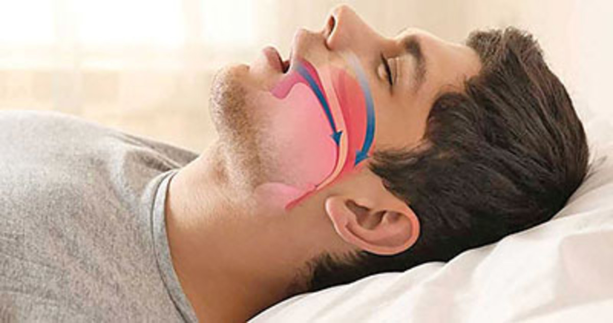 تاثیر مصرف سبزیجات بر آپنه خواب