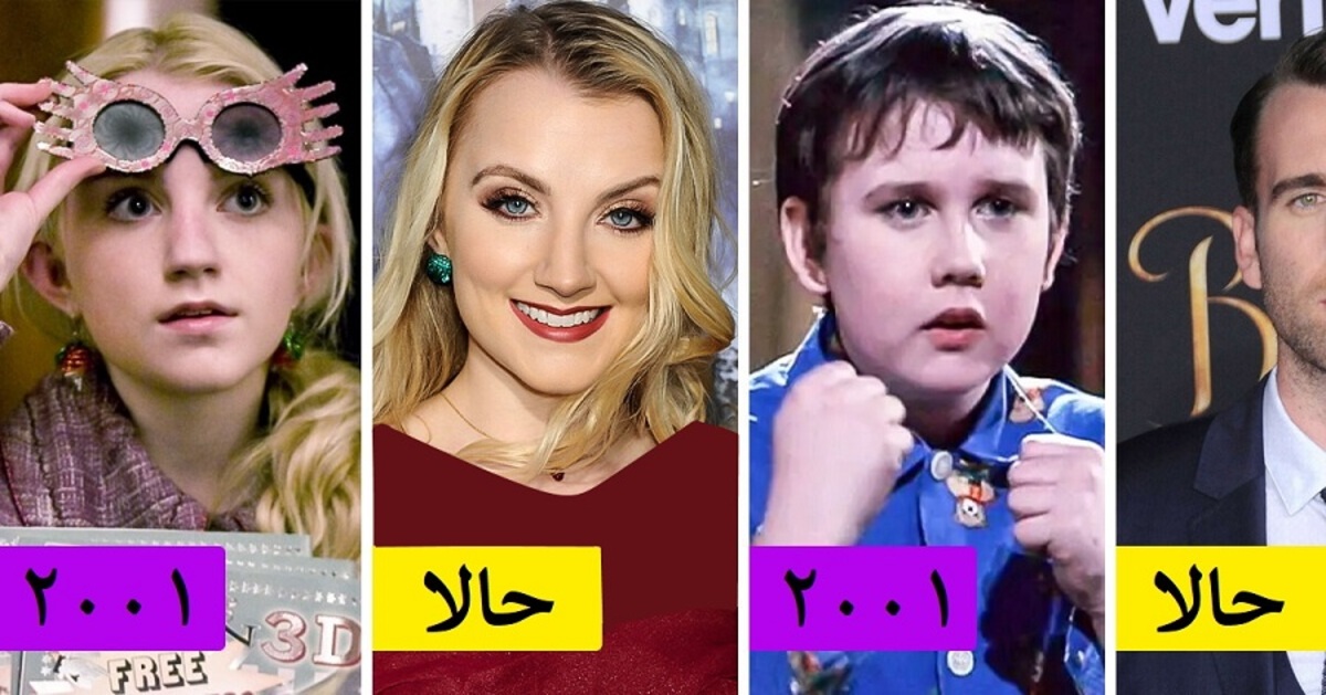 تغییرات اساسی بازیگران سریال هری پاتر بعد از ۲۰ سال