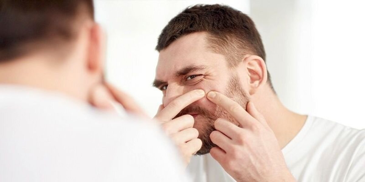 پنج ویژگی اصلی جوش‌های هورمونی
