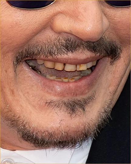 دندان‌های خراب و افتضاح “جانی دپ” سوژه عکاسان شد/ عکس