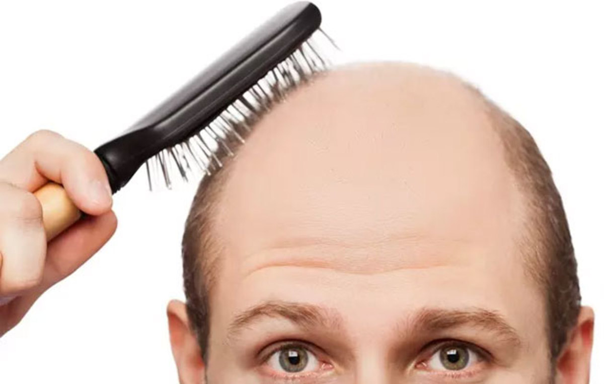 چند ترفند عالی برای جذاب شدن مردان کچل