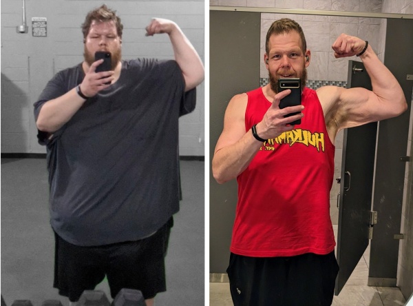 عکس قبل و بعد کول پروچاسکا بعداز ۱۵۰ کیوگرم کاهش وزن!