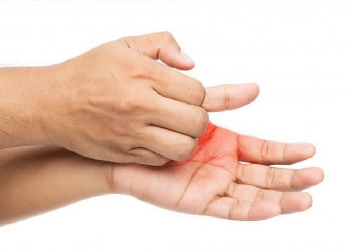ژنتیک یکی از عوامل چندگانه تعریق بیش از حد کف دست و پا