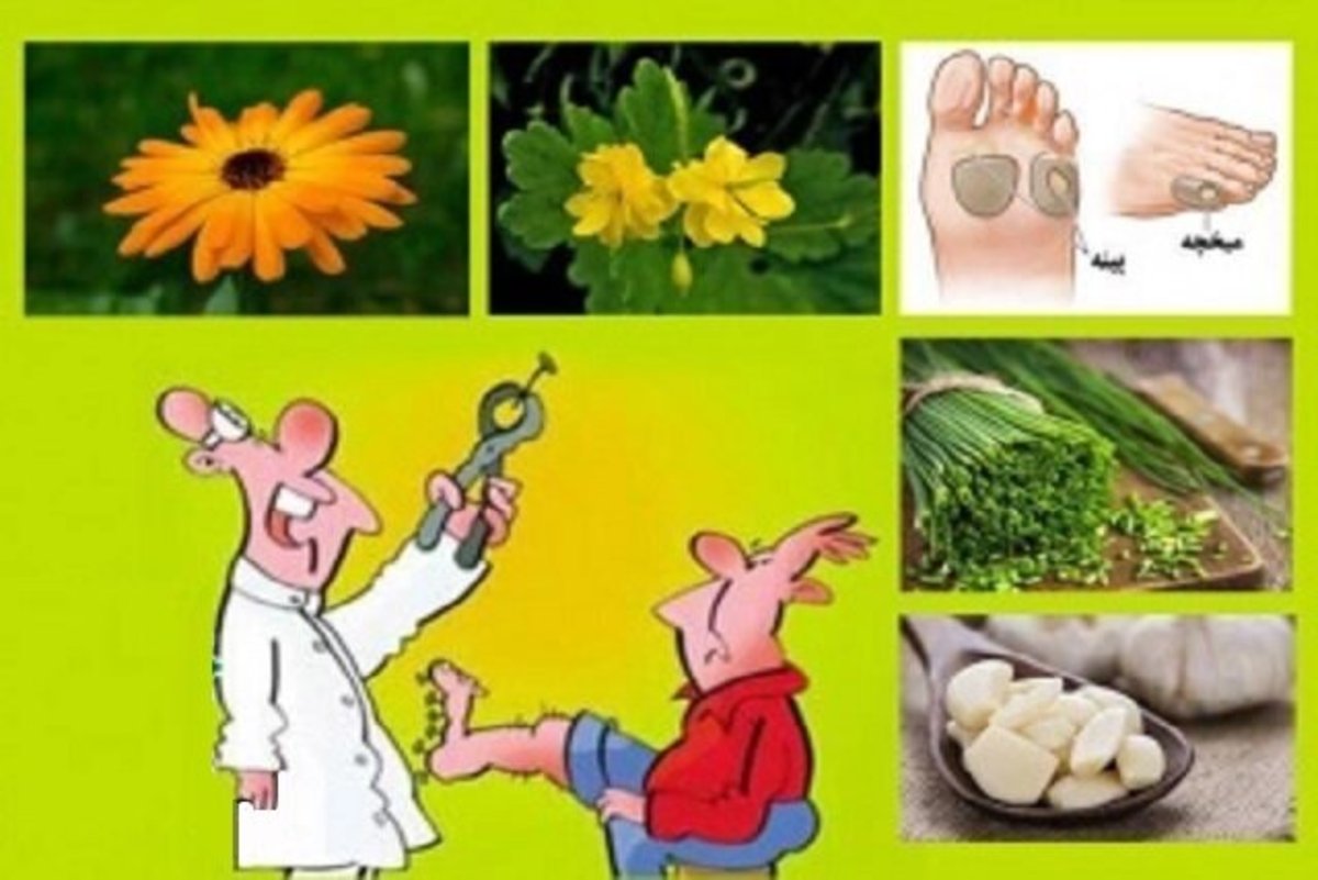 میخچه و پینه را با این گیاهان داراویی نیست و نابود کنید