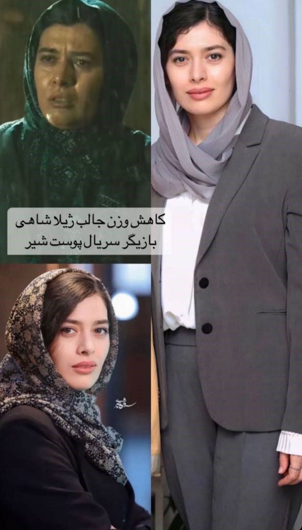 راز لاغری بازیگر جذاب سریال پوست شیر برملا شد