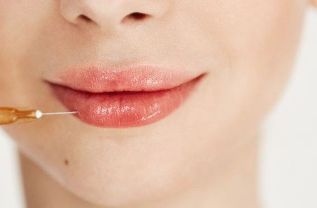 انواع فرم‌های متفاوت تزریق ژل به لب