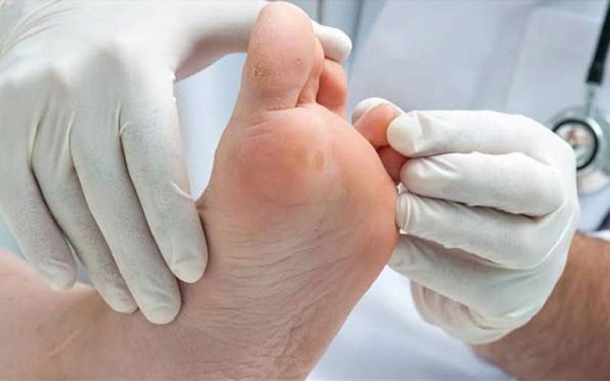تولید زخم پوش‌های ضدباکتری برای درمان زخم‌های دیابت