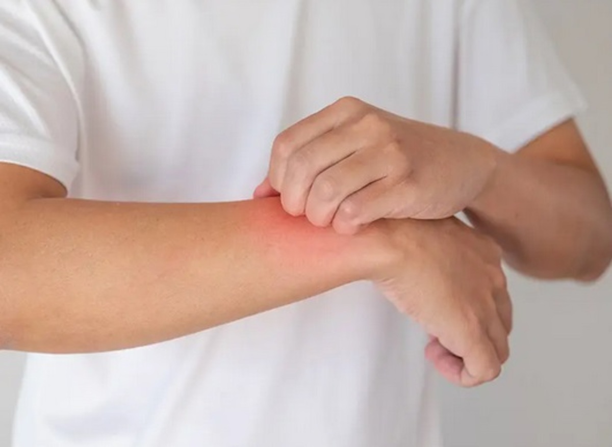 اگر پوست تحت استرس شدید قرار بگیرد چه میشود؟