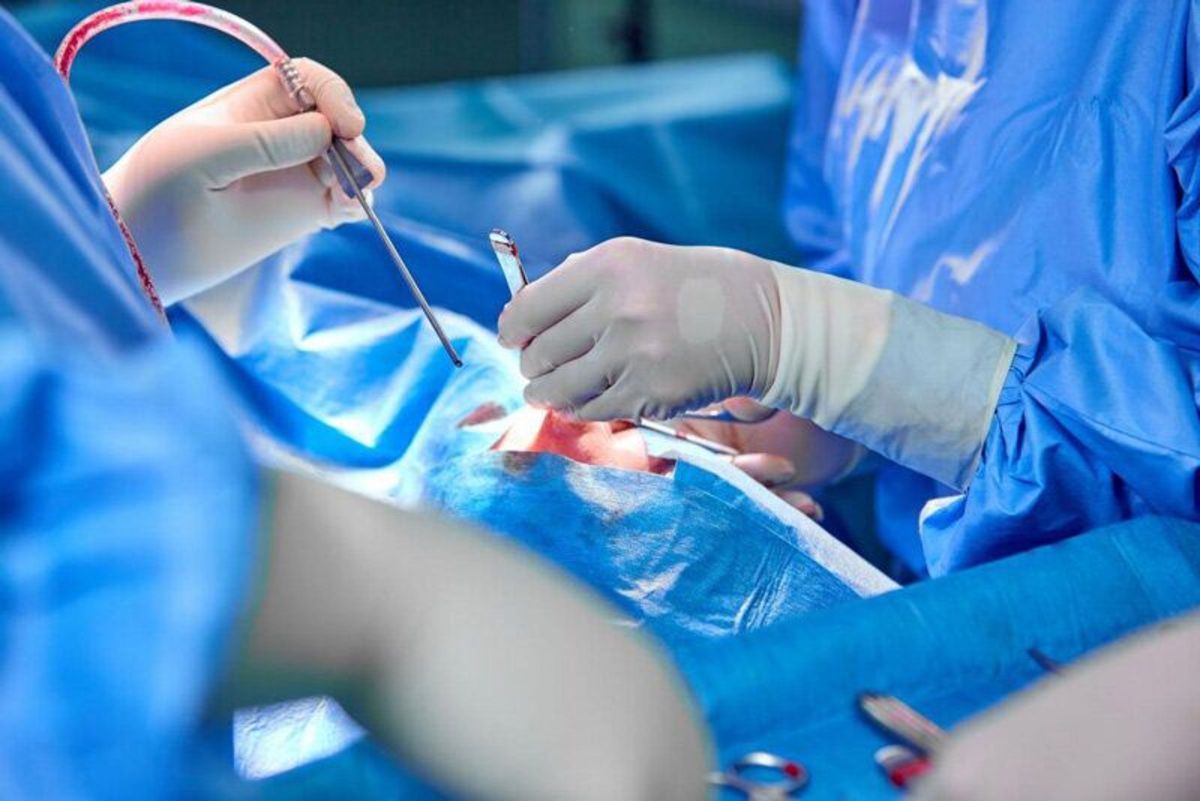 هیسترکتومی چیست و چه عوارضی دارد؟