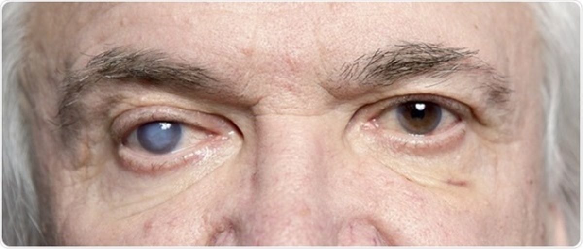 رتینوپاتی دیابتی (DR) در مرحله اولیه مولکولی با این طراحی شناسایی میشود