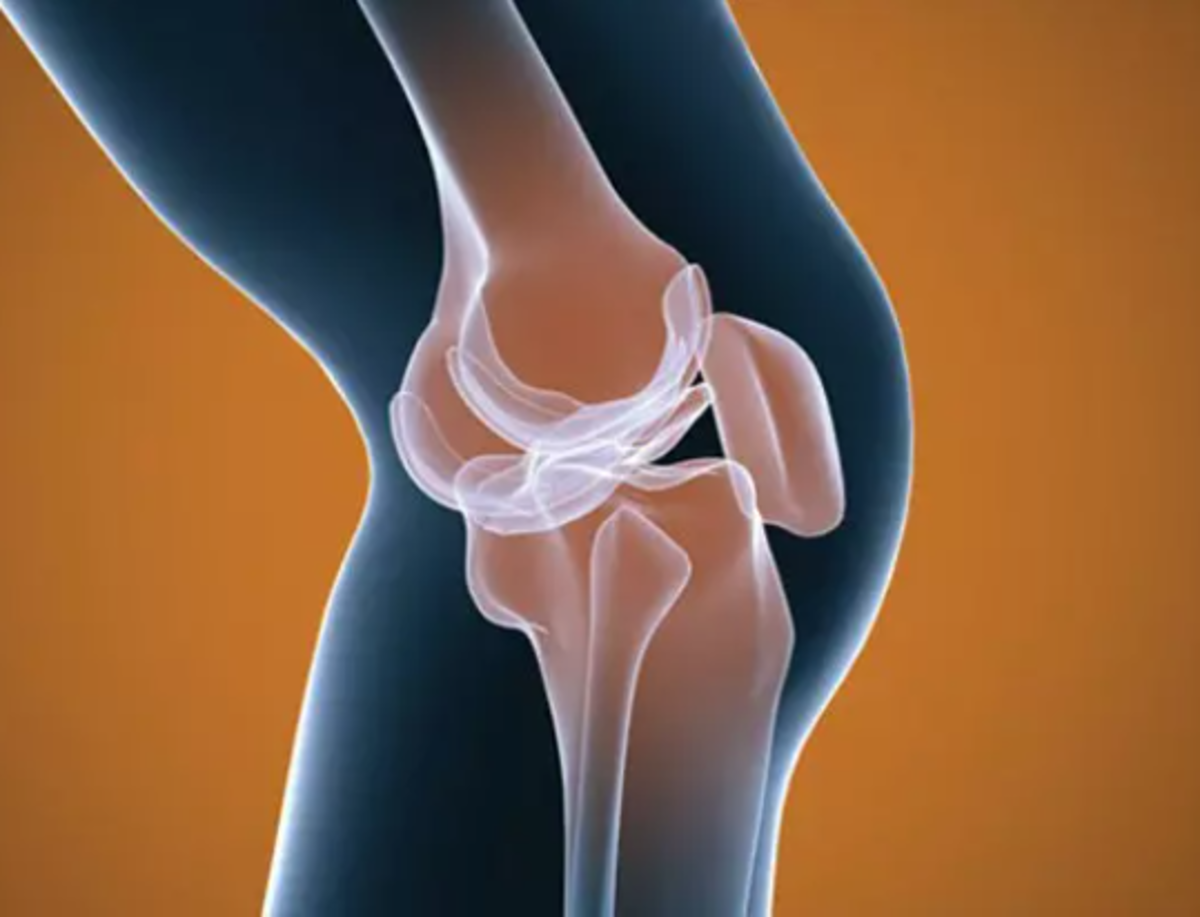یکی از شایع‌ترین بیماری تخریبی از میان مفاصل بدن را بشناسید