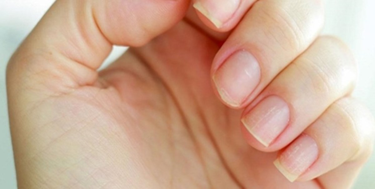 این بیماری در کمین افرادی است که ناخن می‌کارند