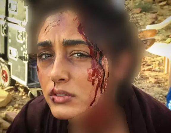 عکس وحشتناک از صورت داغون گلشیفته فراهانی!