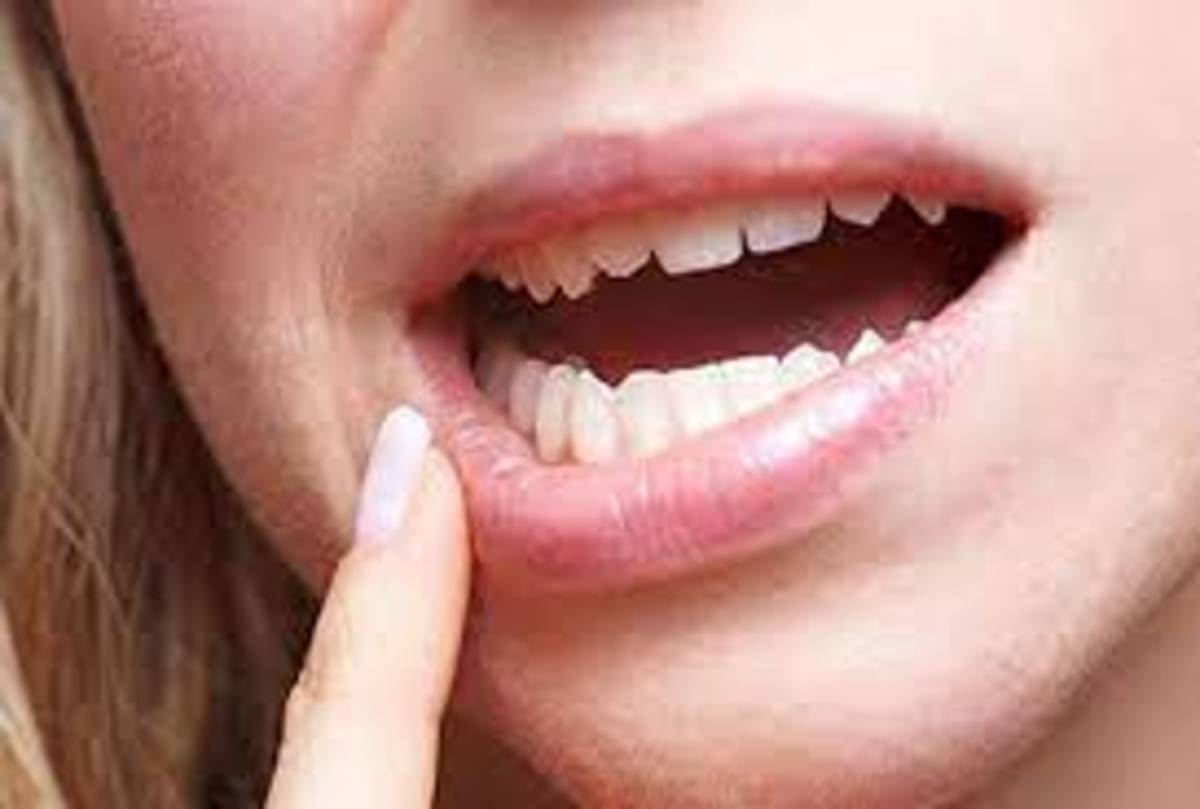 علائم و روش‌های تشخیص و درمان سرطان خطرناک لب چیست؟