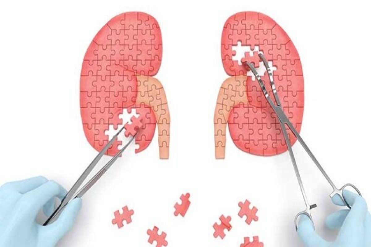 سه توصیه مهم برای سلامت کلیه