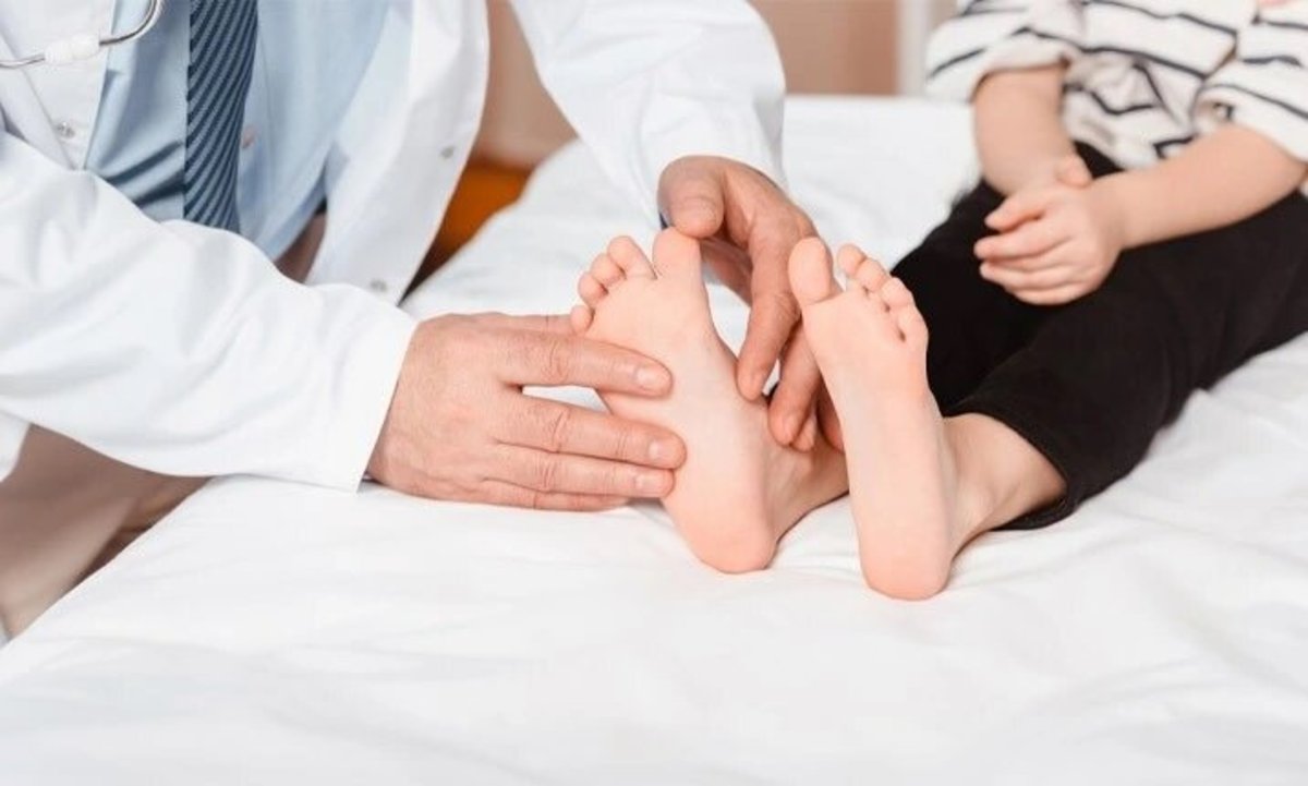 مشکلاتی کف پای صاف ایجاد میکند