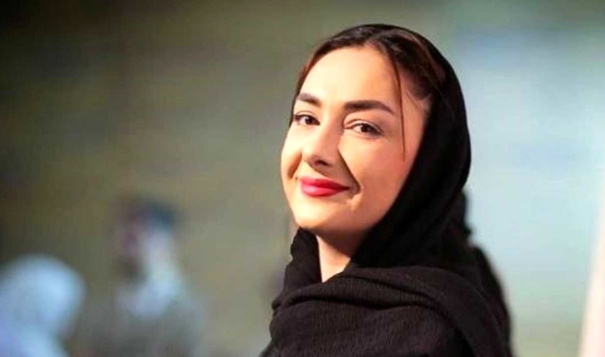 چهره خانم بازیگر قبل از عمل‌های زیباییش شوکه کننده است! /عکس