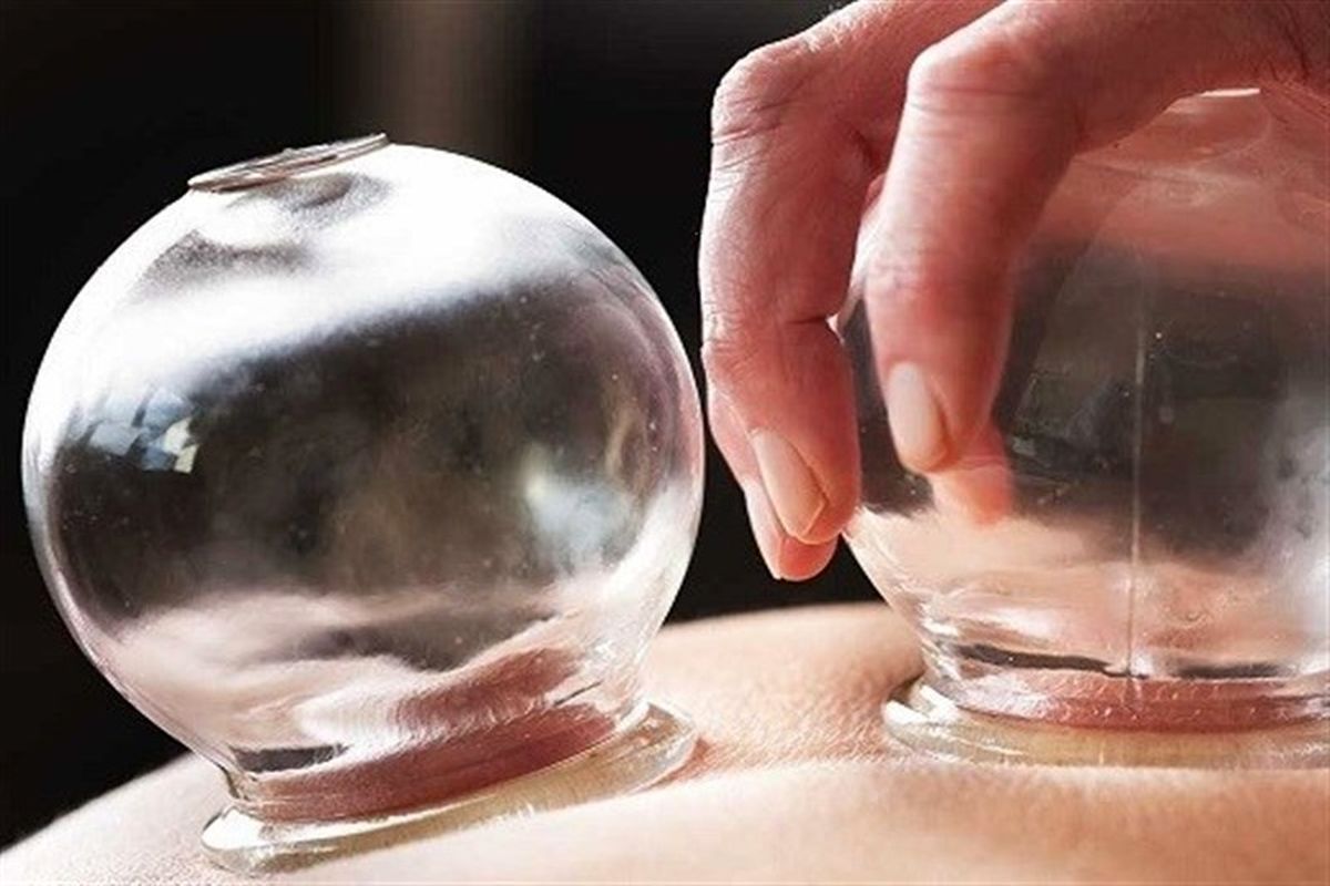 خود تنظیمی عملکرد بدن انسان به کمک حجامت