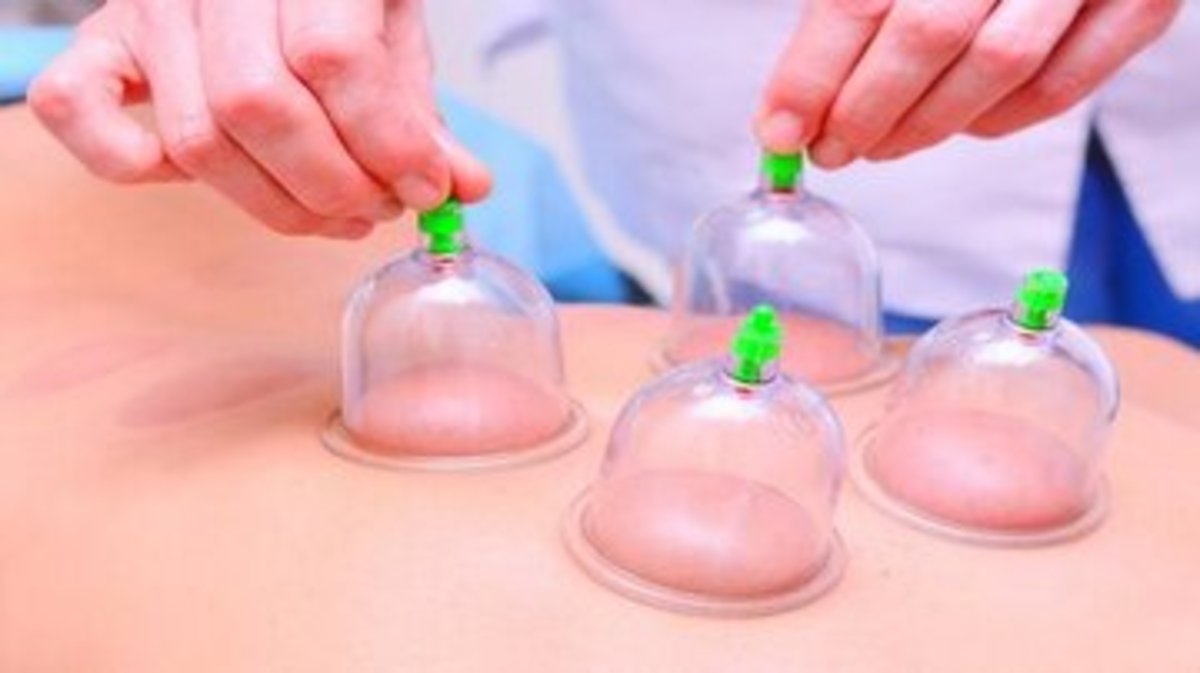مکانیسم تاثیرات حجامت بر بدن