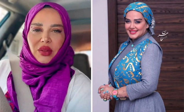 عکسی از بهاره رهنما با لبهای پف پفی/نبینی ازدستش دادی! عکسی از بهاره رهنما با لبهای پف پفی/نبینی ازدستش دادی!