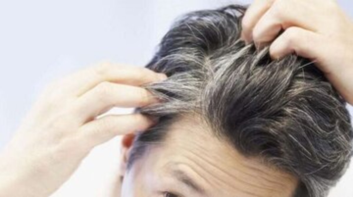 شش راه استفاده از جوش شیرین برای کمک به سلامتی موهایتان