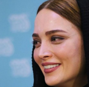 تغییر فاحش چهره بهنوش طباطبایی بعد عمل زیبایی + عکس قدیمی و جدید خانم بازیگر