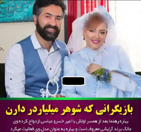 زیبایی عروسکی بهاره رهنما در ۵۰ سالگی / جذابیت مصنوعی اش را ببینید!