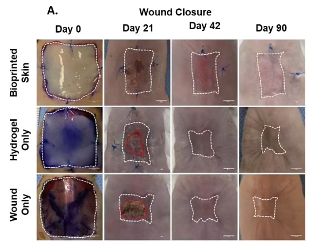 درمان سریع زخم به کمک یک روش نوین در پیوند پوست
