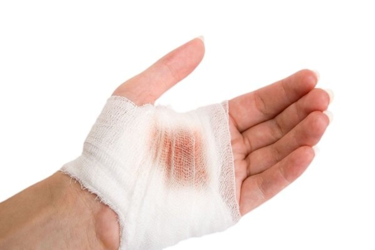 در مواجهه با خونریزی چه کنیم؟