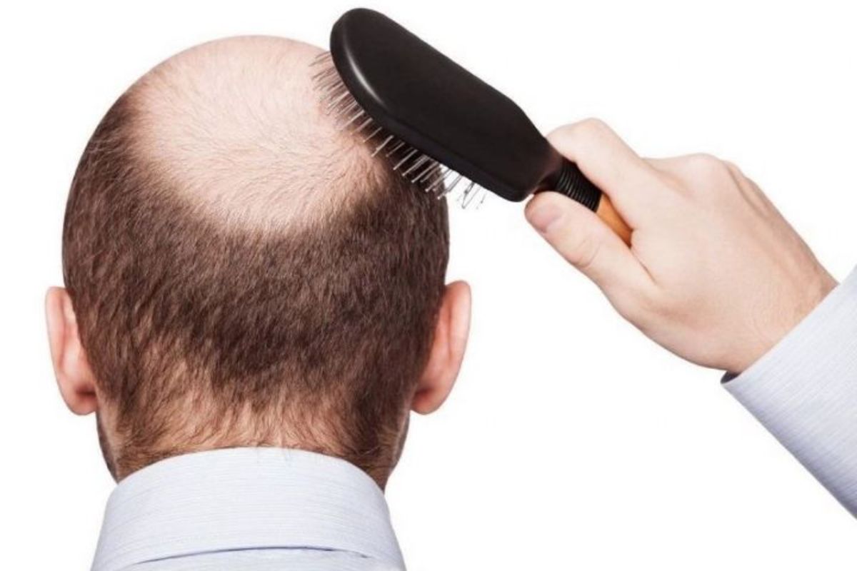 نقش تغذیه در سلامت پوست و مو