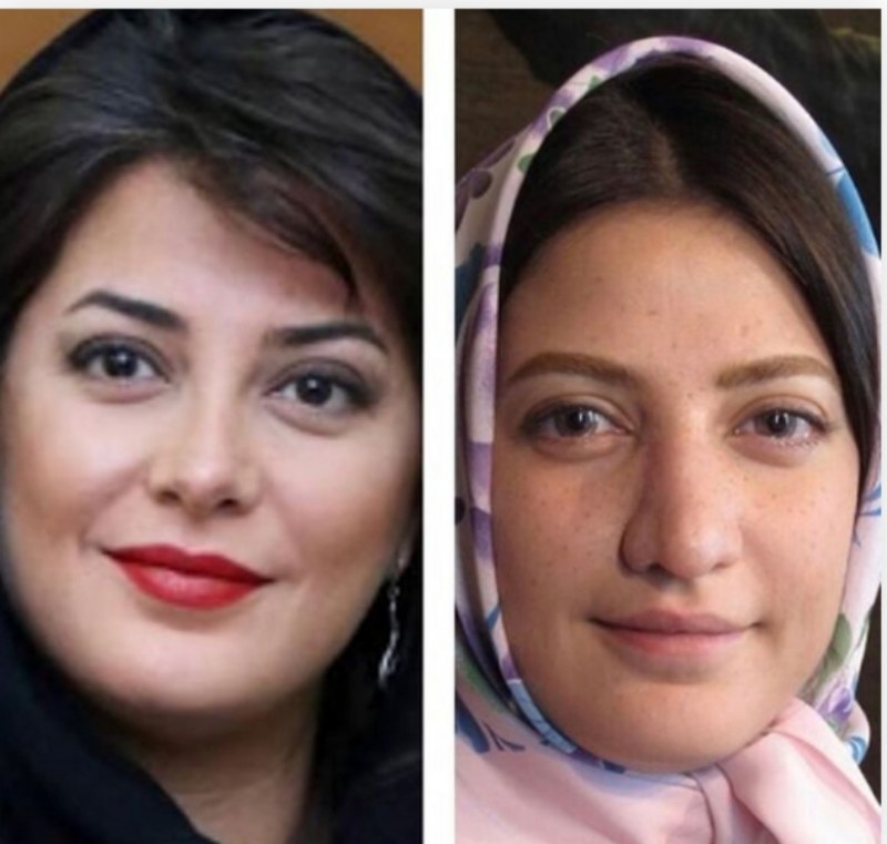 باورتان می‌شود این چهره “طناز طباطبایی” قبل عمل زیبایی باشد/ عکس