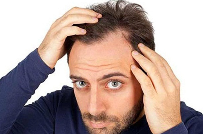 چند دلیل که درد مو‌ها را توجیه می‌کند