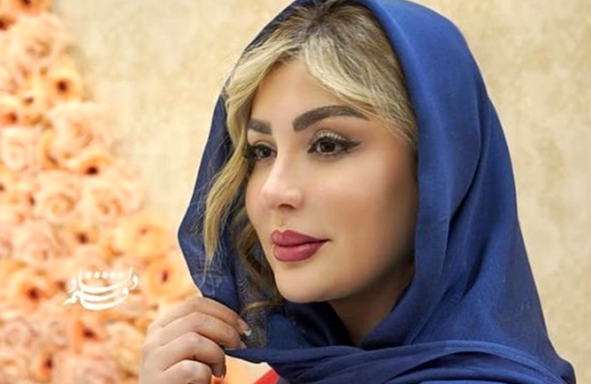 عمل‌های زیبایی خانم بازیگر پایان ندارد! /تغییر چهره جدید نیوشا ضیغمی شوکه کننده است!