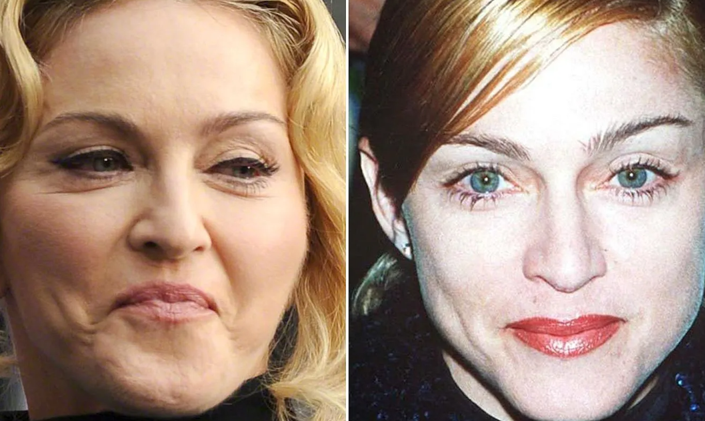 جراحی پلاستیک‌های متعدد مدونا چهره او را ناشناس کرد/قبل و بعد را ببینید