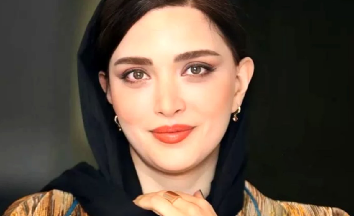 تصویر منتشر شده از خانم بازیگر که مورد ضرب و شتم شدید قرار گرفته است! /لبخند دردناکش را ببینید