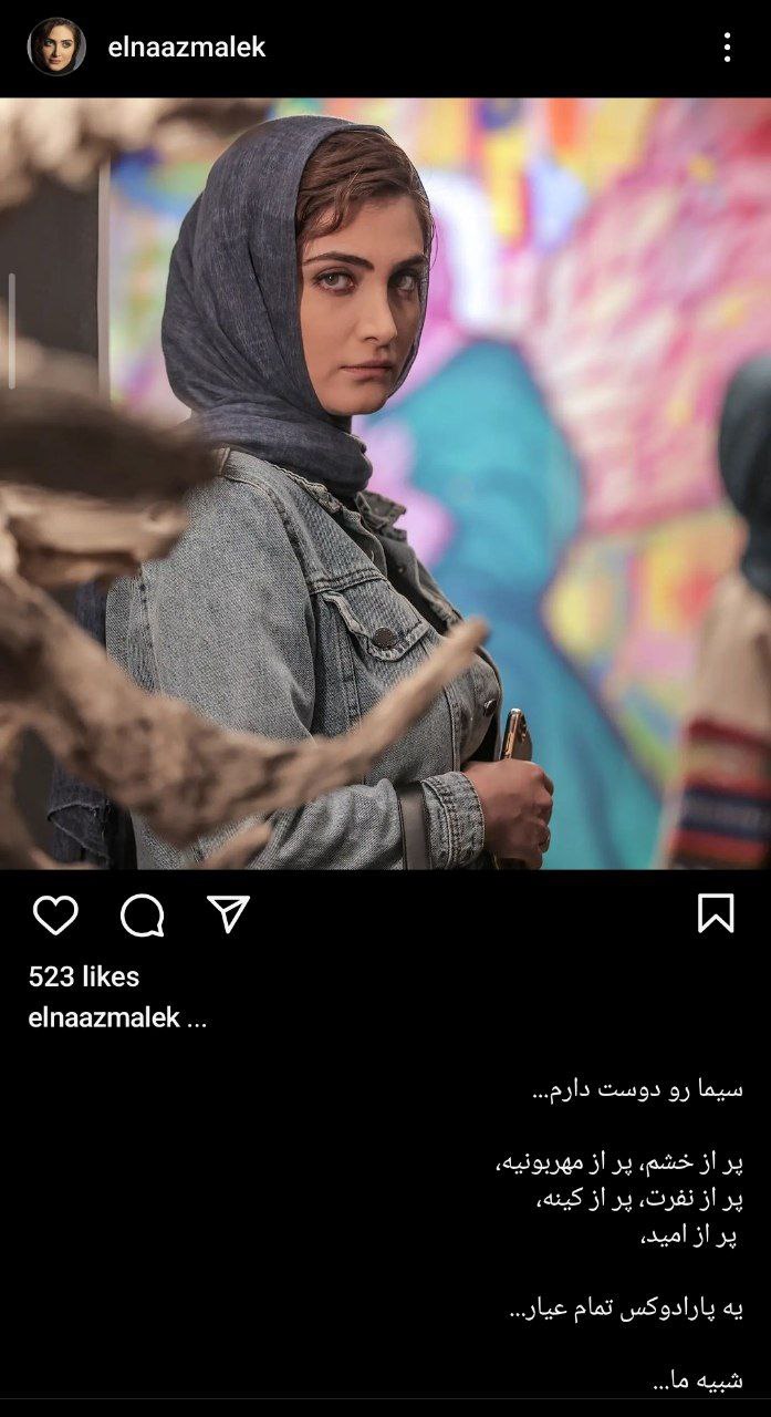 “الناز ملک” با چهره جدیدی که رو کرد همه شوکه شدند+تصویر