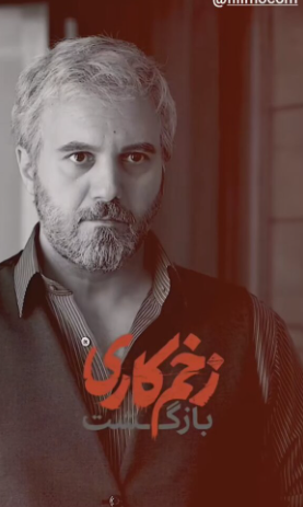 بازیگر زخم کاری از گریم جدیدش رونمایی کرد +عکس