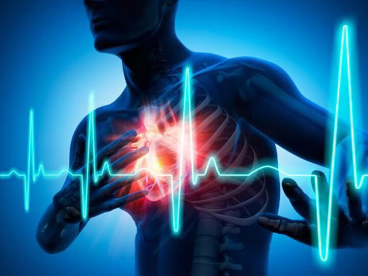 فیبریلاسیون دهلیزی درمان نشده منجر به چه چیزی میشود؟